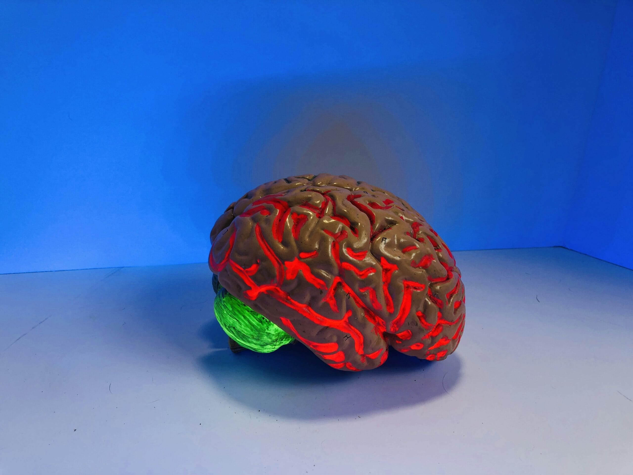 Exploring Which Ethnicity Has The Highest Rate Of Dementia Globally