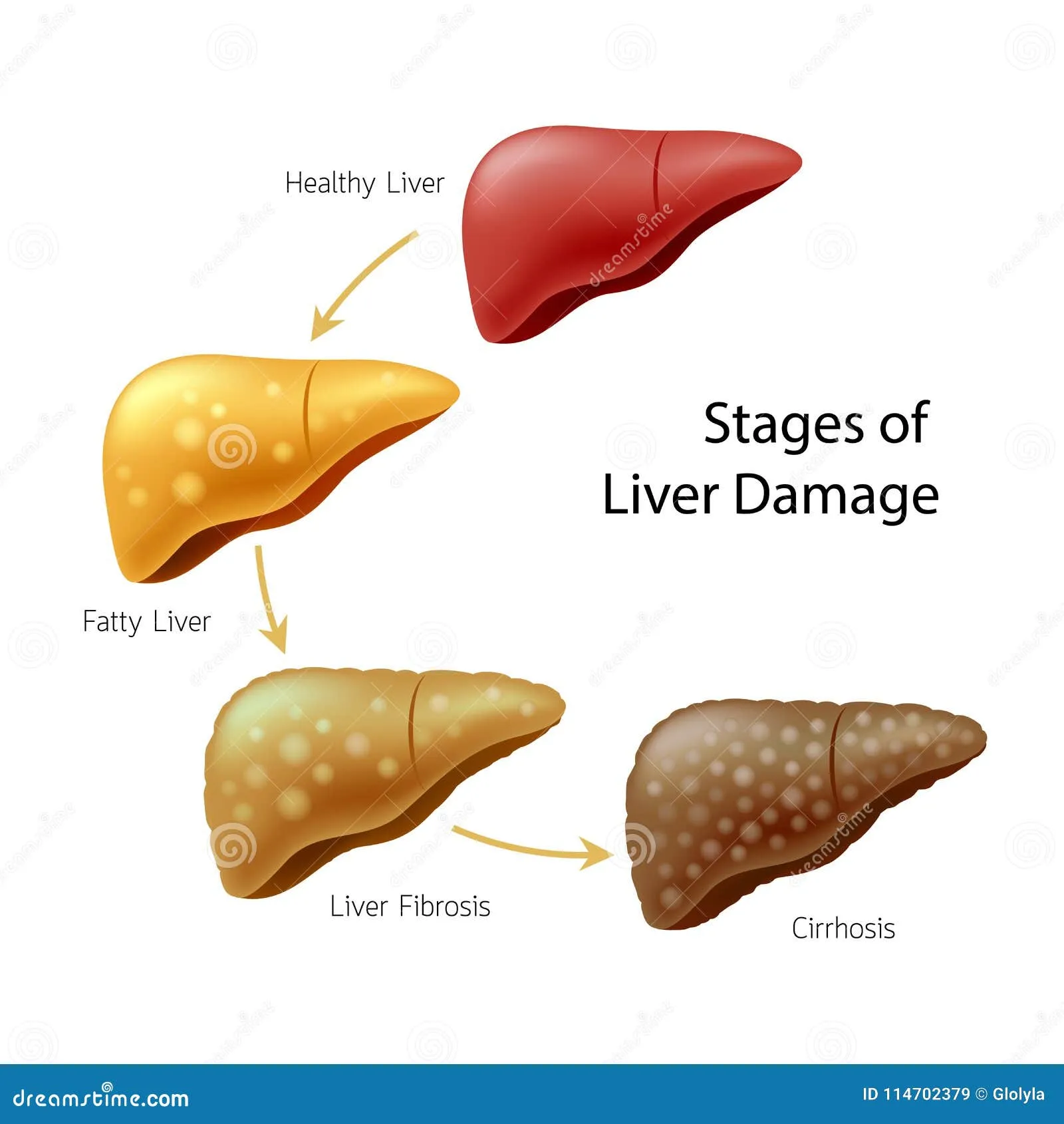Understanding Liver Belly: Causes, Symptoms, and Solutions