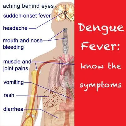 Dengue Fever Symptoms and Treatment Options