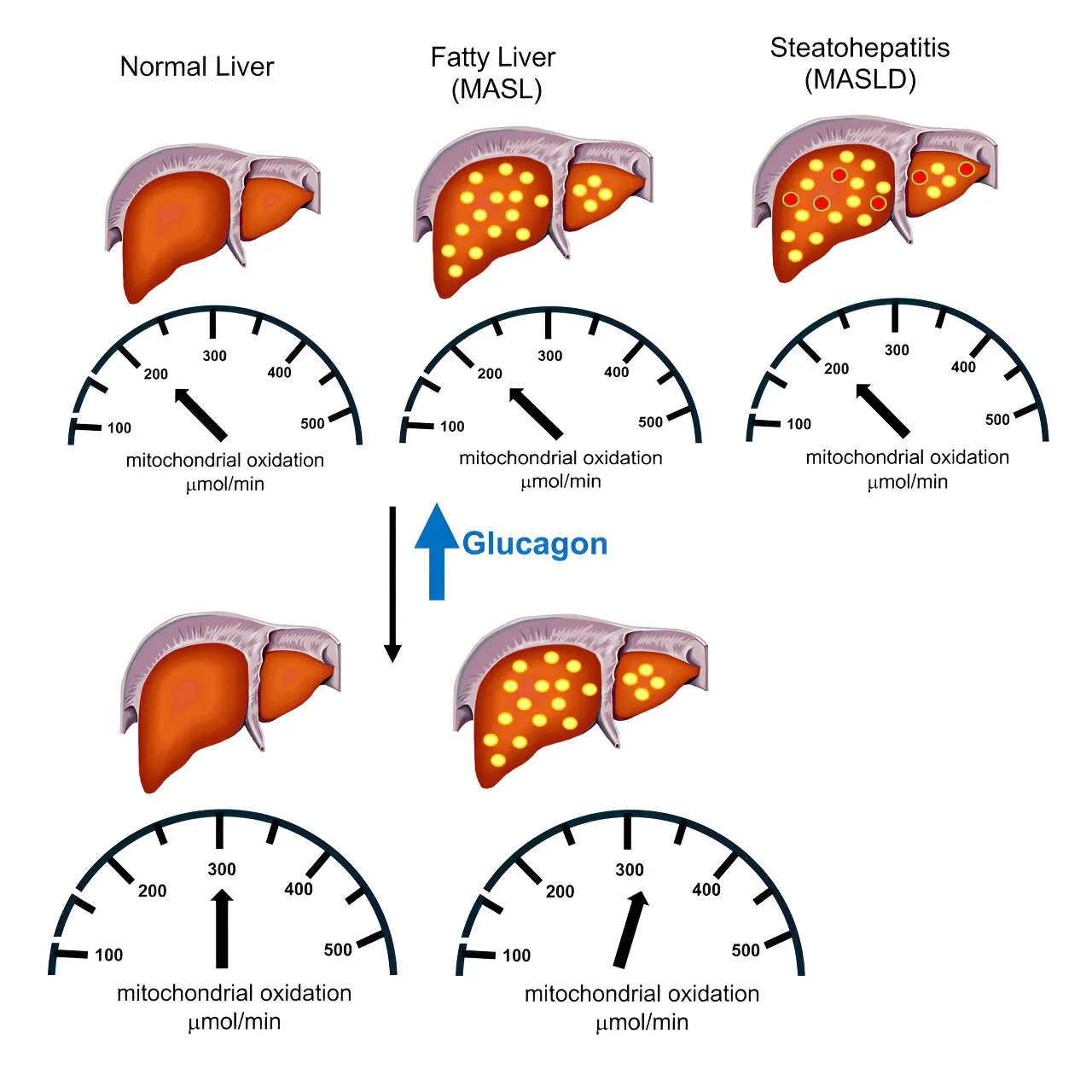 Boosting Fat Oxidation for Better Liver Function: A Closer Look