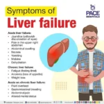 5 Warning Signs Your Liver Could Be Slowing Down Your Metabolism