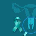 A Guide To a Comfortable Cervical Screening with Dr. Unsworth