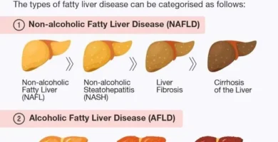 Breaking Down the Top Contributors to Fatty Liver Disease