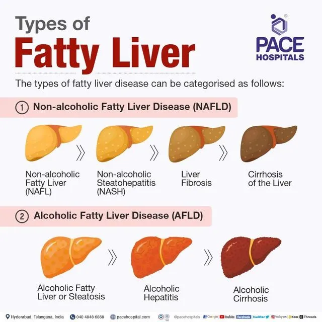Breaking Down the Top Contributors to Fatty Liver Disease