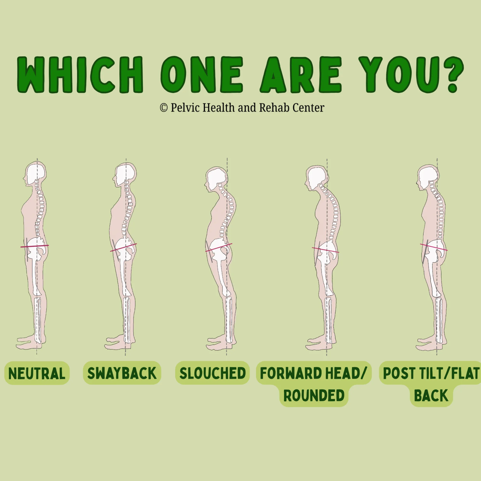 From Posture to Pelvic Floor