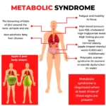 Understanding the Impact of Metabolic Syndrome on Liver Function